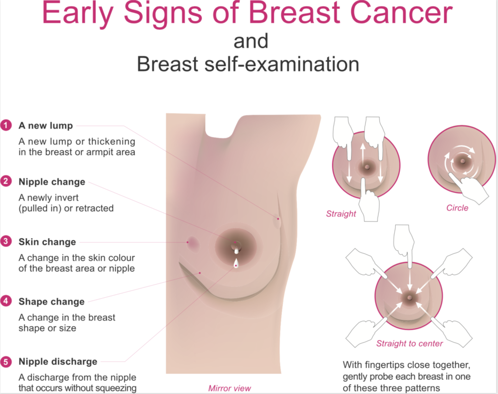Inflammatory Breast Cancer - Medical Tech News : The 