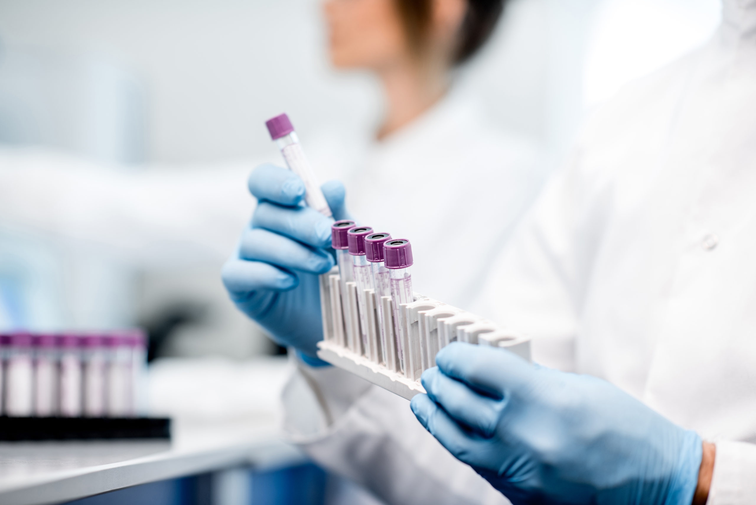 Laboratory testing